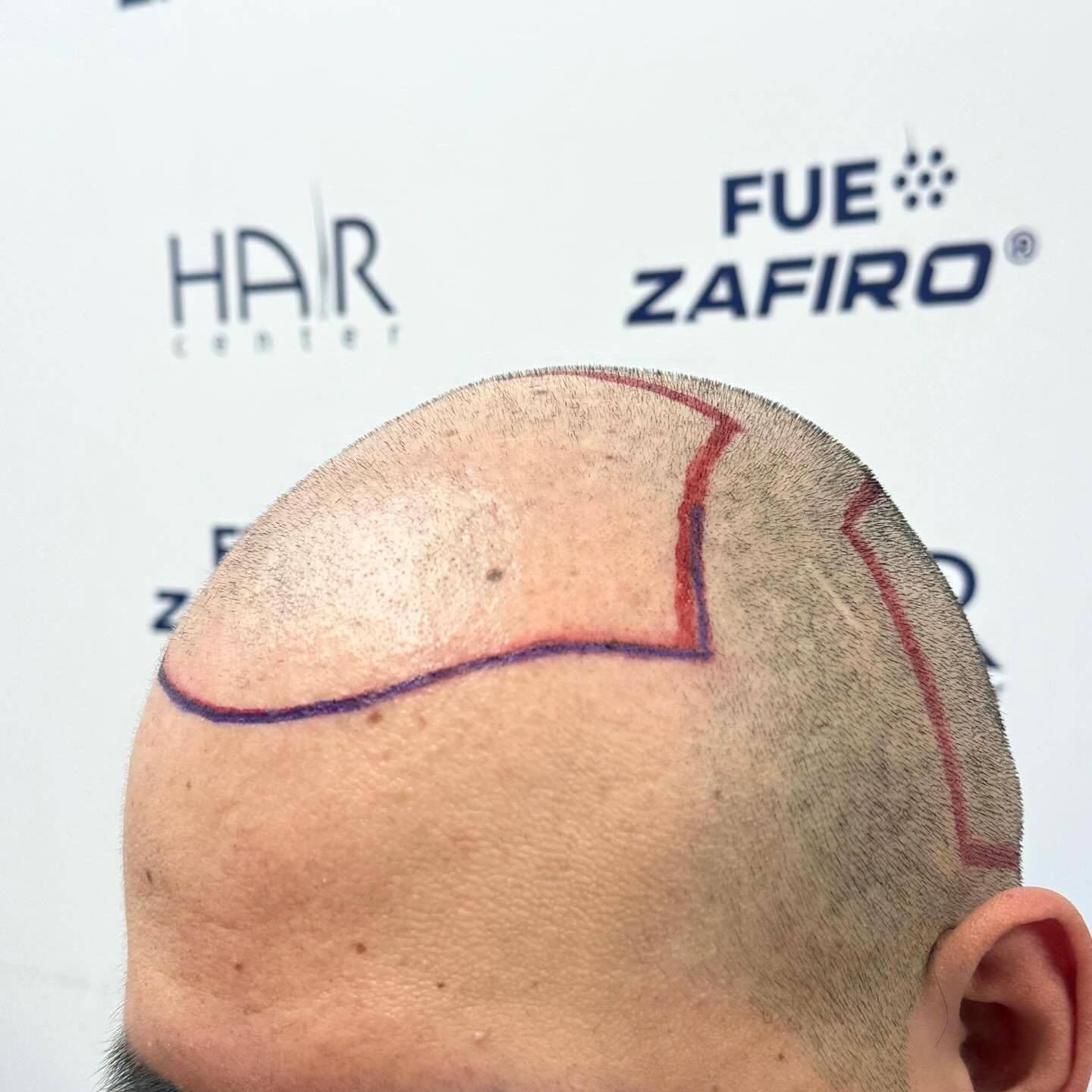 proceso2