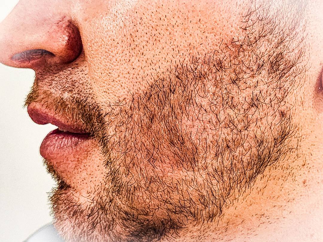 Barba3