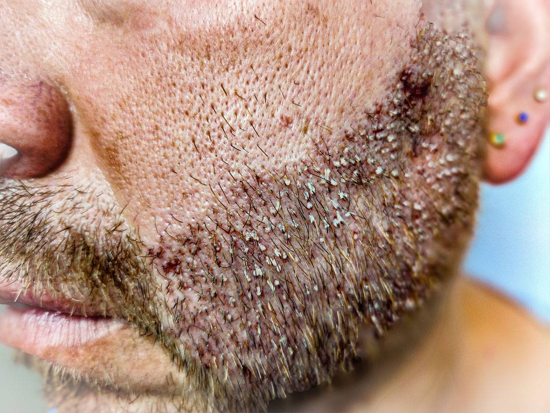 Barba6